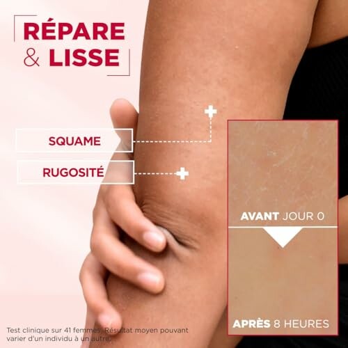 Comparaison du coude avant et après traitement de la peau.